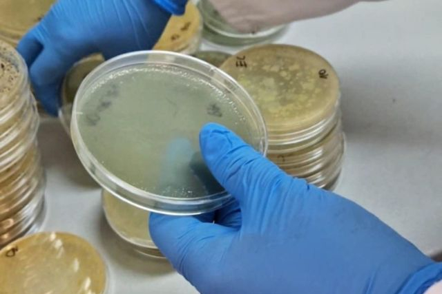 Ważność mikrobiologii w naszym życiu 