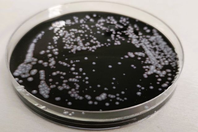 Legionella w wodzie - co warto wiedzieć?